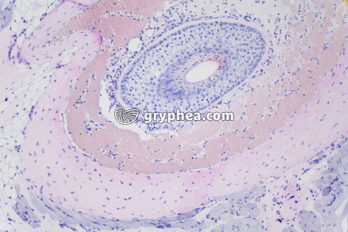 Peau avec glandes sébacées x40 - gryphea.com